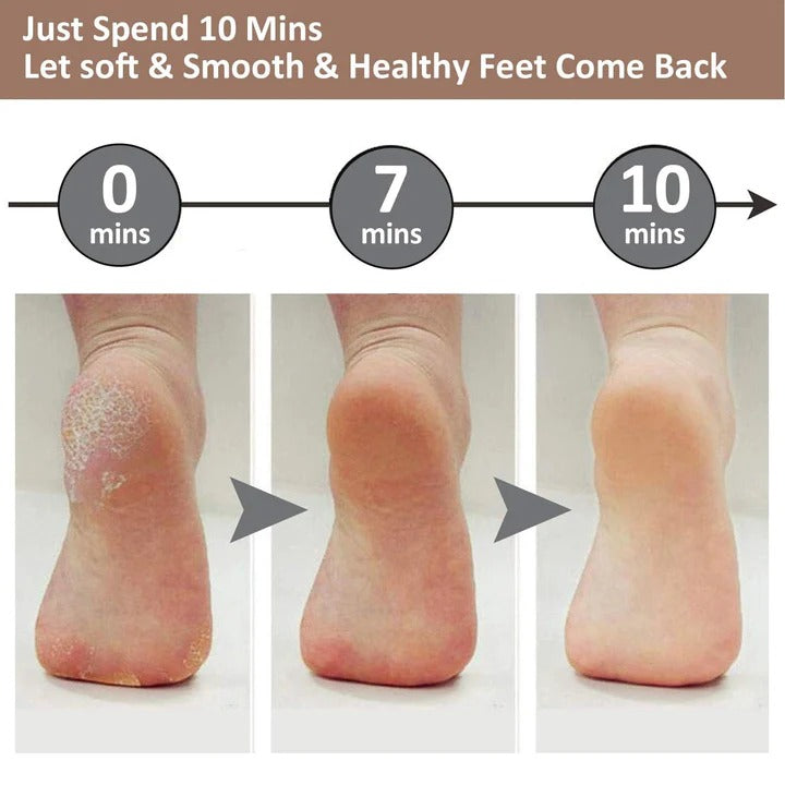 ELECTRIC FEET CALLUS REMOVER