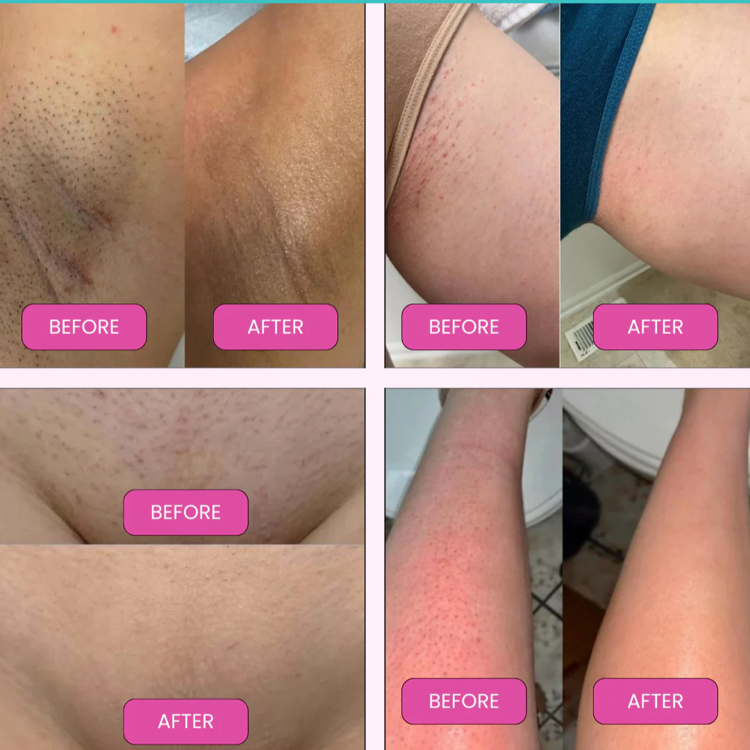 SmoothShave™ Razor